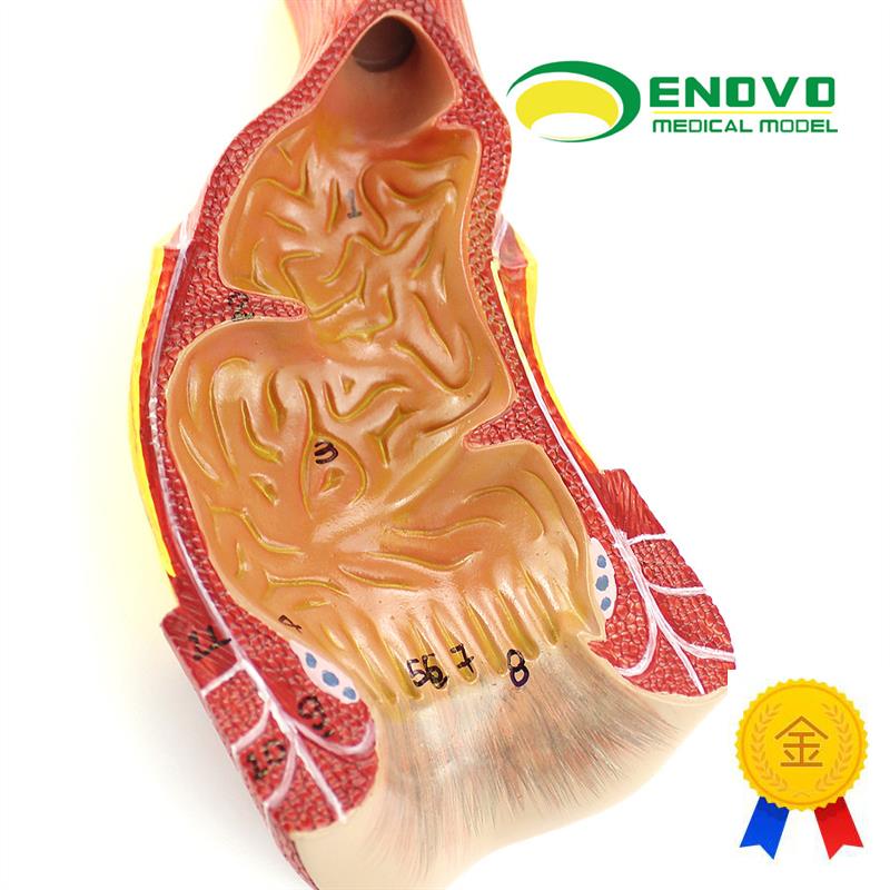 ENOVO颐诺医学人体直肠肛管肛门解剖结构模型肛肠U科外科消化系统