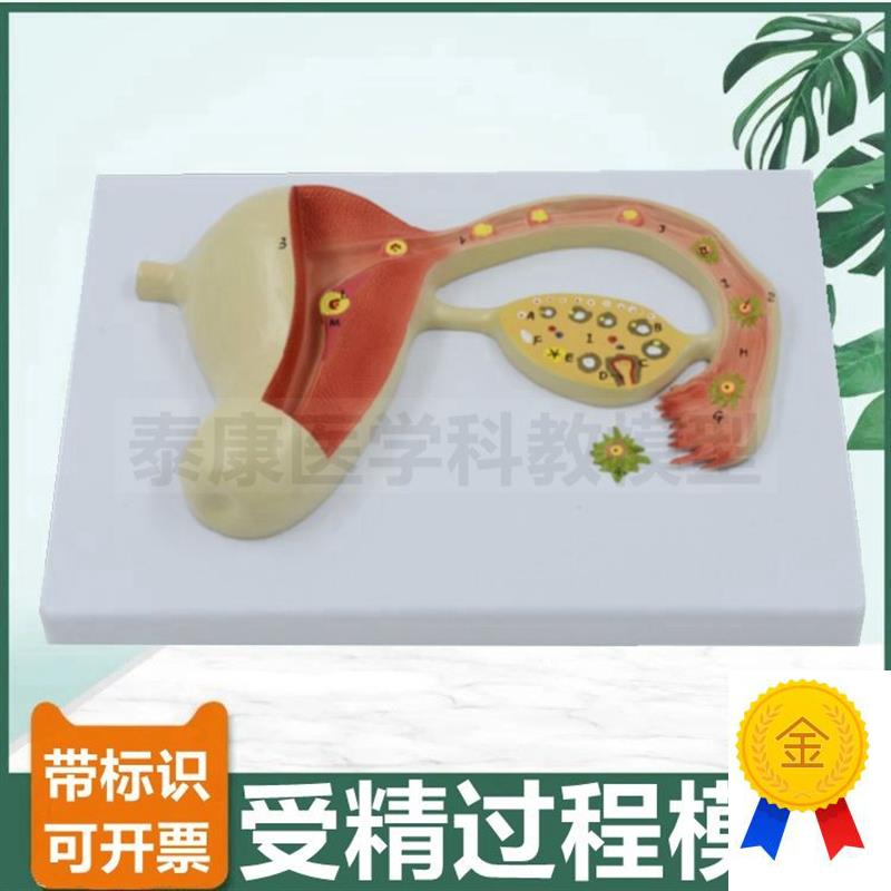 受精过程模型精子和卵子结合生殖胚胎妊娠发育过程妇Y产科教学用