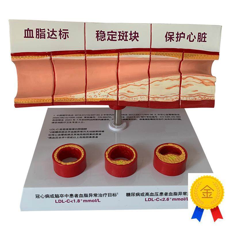 血管活动c堵塞动支脉粥样硬化心血管动脉硬化模型血管病理模型血