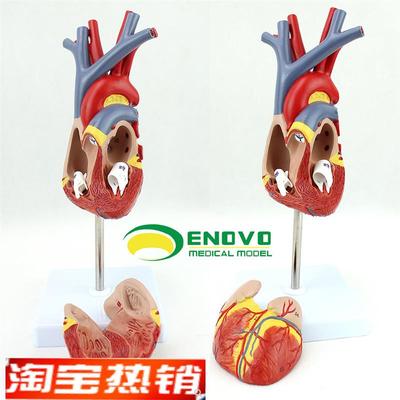 ENOVO颐诺人体心脏模型医学心血管内科心脏介入解剖教学冠状动脉
