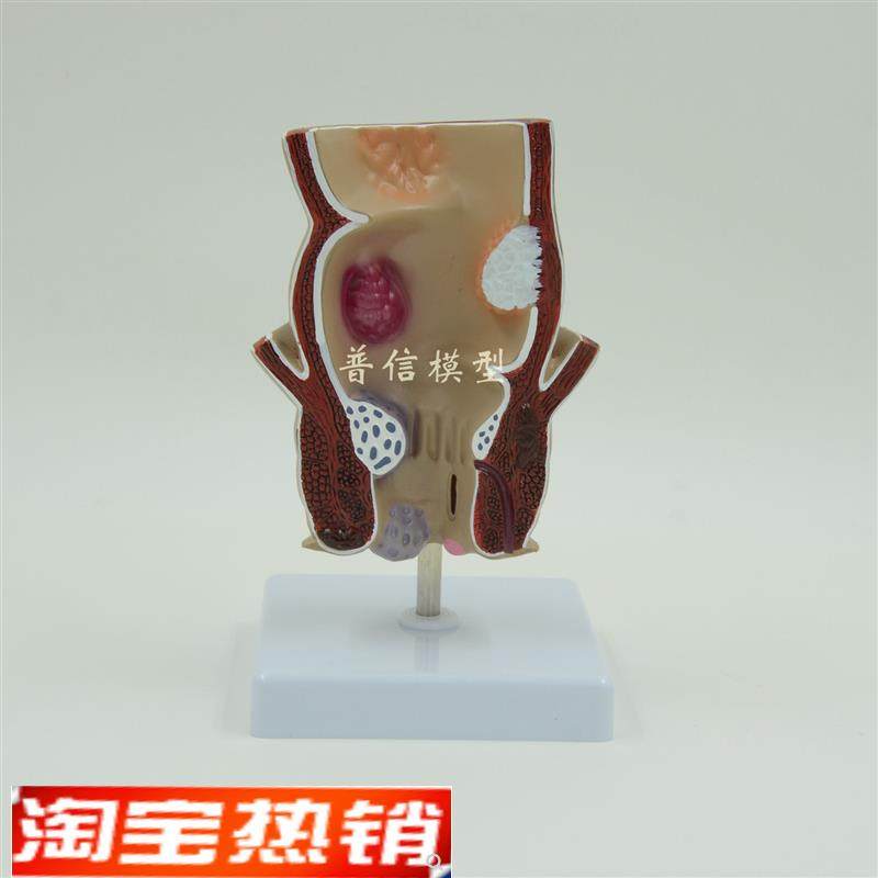 普信仿真人体直肠结肠演示模型 教用医用肛肠科教学沟通用具解剖,玩具/童车/益智/积木/模型,其他模型玩具,淘宝优惠券,粉丝福利购,淘宝优惠卷