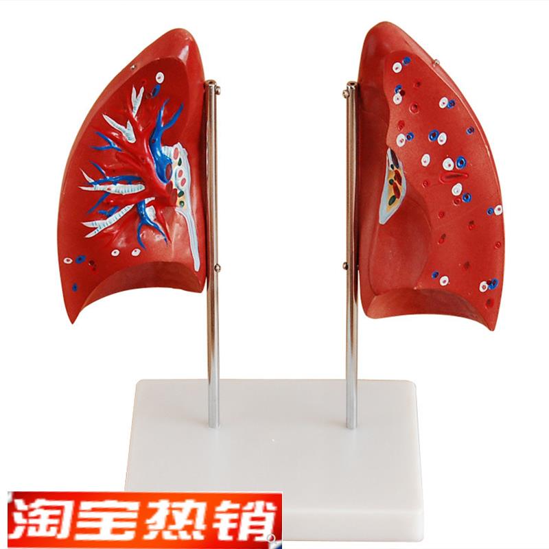 肺解剖模型/肺部模型二件/人体模型/美术学院专用/教学示范