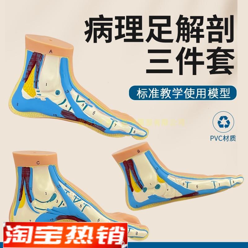 脚模型正常足扁平足弓型足解剖模型脚部构结构造肌肉血管教学医学