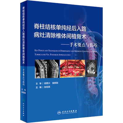 脊柱结核单纯经后入路病灶清除与椎体间植骨术——手术要点与技巧 张宏其 编 外科学生活 新华书店正版图书籍 人民卫生出版社