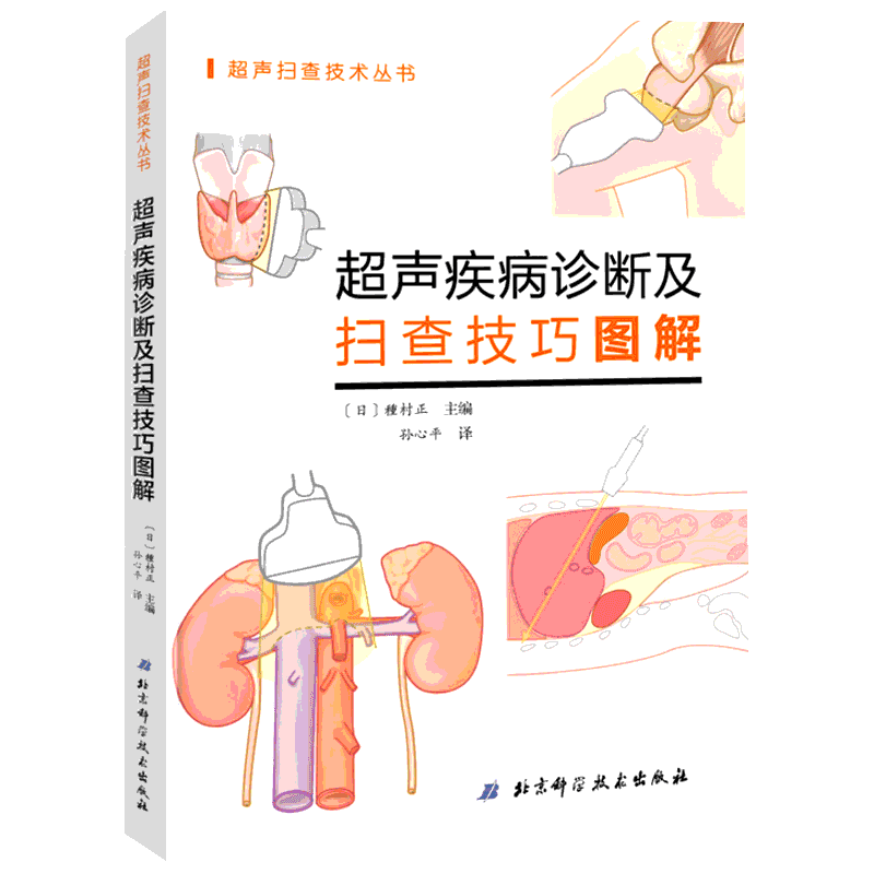 超声疾病诊断及扫查技巧图解 日種村正 清晰的超声解剖规范的扫查方法 准确操作 抓住诀窍 北京科学技术出版社