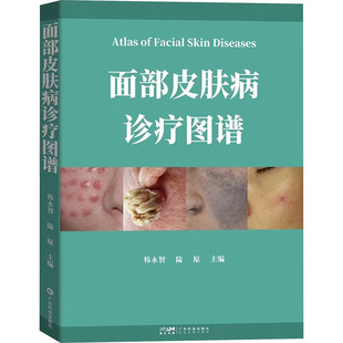 面部皮肤病诊疗图谱 韩永智,陆原 编 皮肤病学/性病学生活 新华书店正版图书籍 广东科技出版社