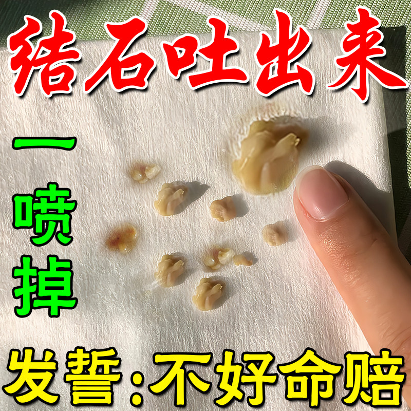 1喷必掉】扁桃体结石去除工具隐窝冲洗器漱口水喉咙发焱肥大肿痛