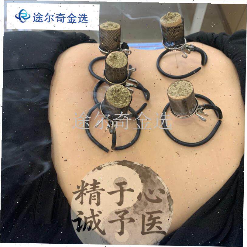 温针灸防落灰器i温针灸无烟艾灸器温针灸针灸器温针灸防烫工具艾