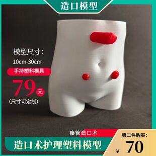 瘘管造口术护理模型肠造口护理人讲解人体手持模型定制