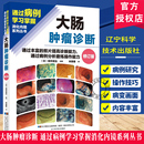 大腸腫瘤診斷通過豐富 照片提高診斷能力通過病例分析磨煉操作能力通過病例學(xué)習(xí)掌握消化內(nèi)鏡系列叢書初中級(jí)醫(yī)生從基礎(chǔ)到實(shí)踐書籍
