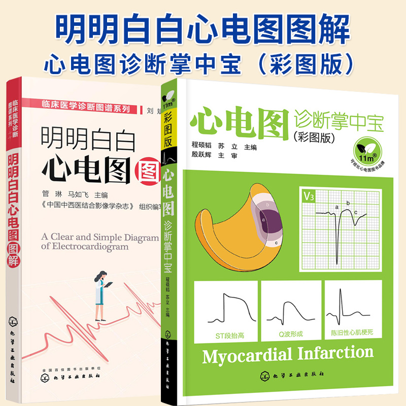 2册】心电图诊断掌中宝 彩图版 +临床医学诊断图谱系列 明明白白心电图图解 临床心电图书籍高手速成诊断手册图谱轻松学习书籍