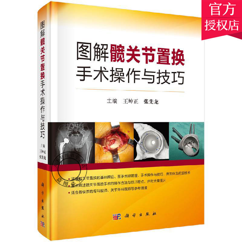 图解髋关节置换手术操作与技巧 王坤正 张先龙 主编 人工股骨头置换术 髋关节表面置换术 外科手术骨关节置换手术书籍 科学出版