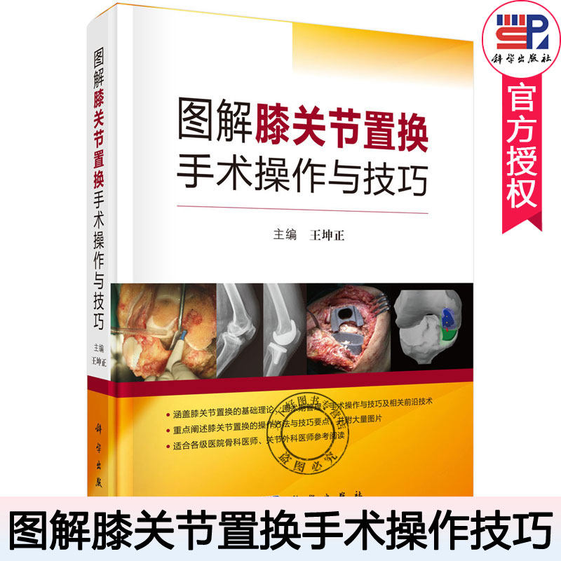 图解膝关节置换手术操作与技巧 王坤正 膝关节置换基础理论围术期管理手术操作技巧 骨科医师关节外科医师临床骨科手术图谱书籍