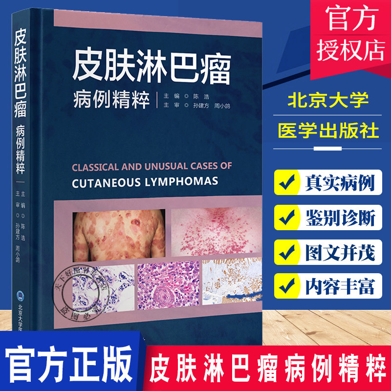 皮肤淋巴瘤病例精粹 陈浩 主编 全书囊括原发皮肤淋巴瘤的所有类型及临床病理亚型 系统淋巴瘤累及皮肤的病例及部分组织细胞病变