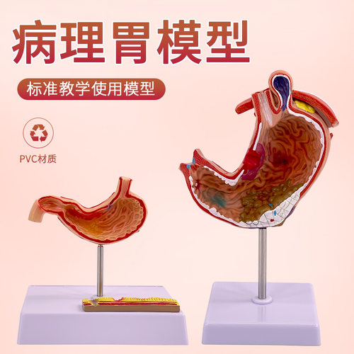 消化系统病理胃模型黄河教学