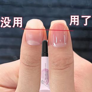 指甲营养液快速修复空心甲护甲改善甲床竖纹防断增厚非手工穿戴甲