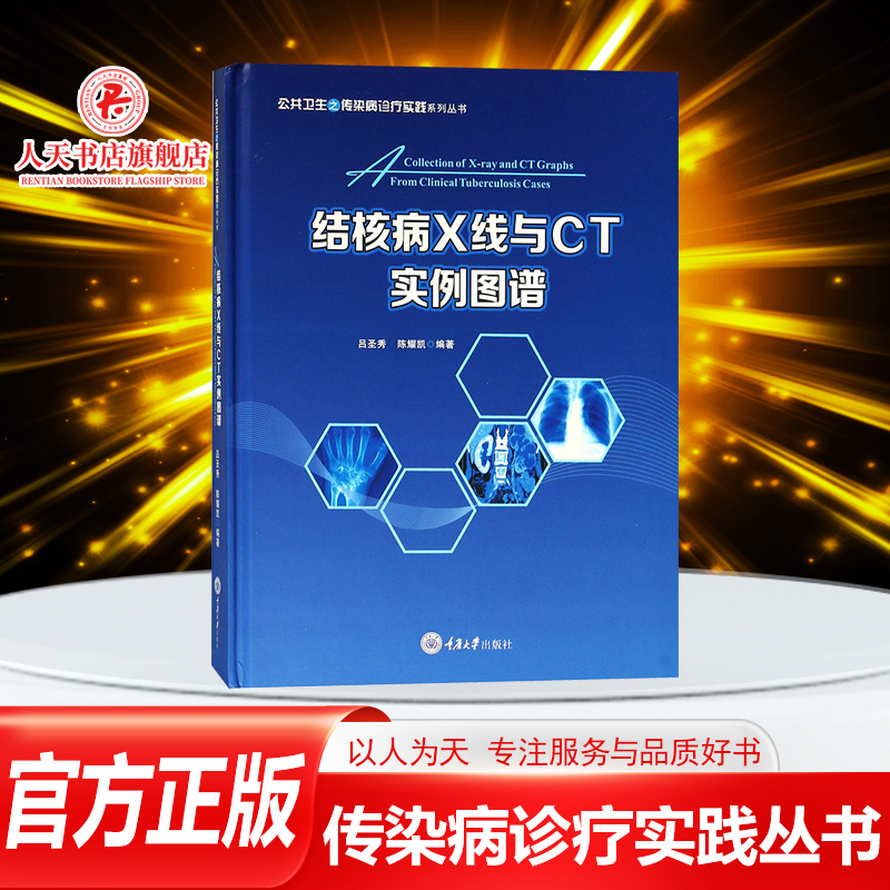 正版书籍结核病X线与CT实例图谱