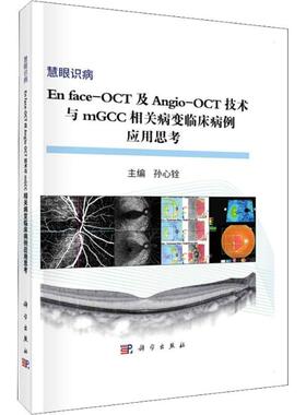 正版书籍 En face-OCT及Angio-OCT技术与mGCC相关病变临床病例应孙心铨科学出版社医药卫生眼病影像诊断病例 人天书店畅销书排行榜
