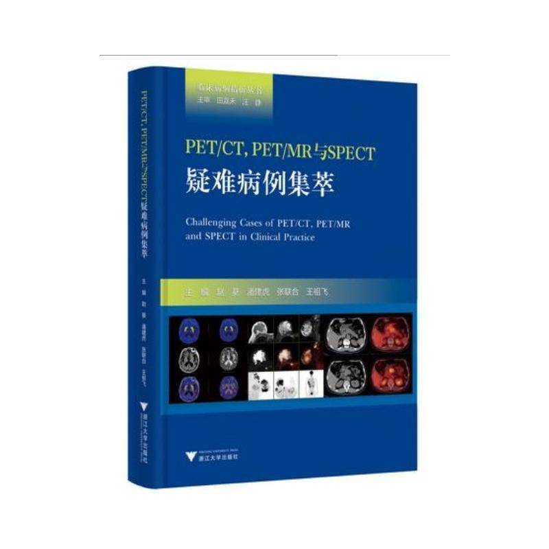正版书籍 PET/CT, PET/MR与SPECT疑难病例集萃赵葵浙江大学出版社医药卫生核医学疑难病病案汇普通大众人天书店畅销书排行榜