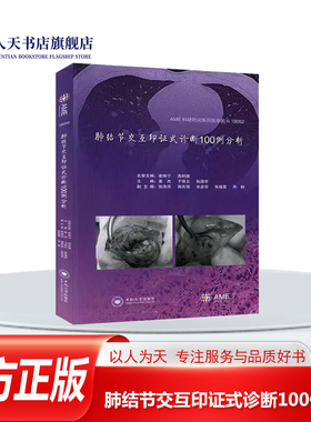 正版书籍 肺结节交互印证式诊断100例分析姜杰中南医药卫生聚焦于当前胸外科的诊治热点肺小结节结具代表性的100例肺小结节病例