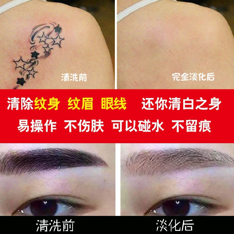 洗纹身药水价格 洗纹身药水图片 星期三