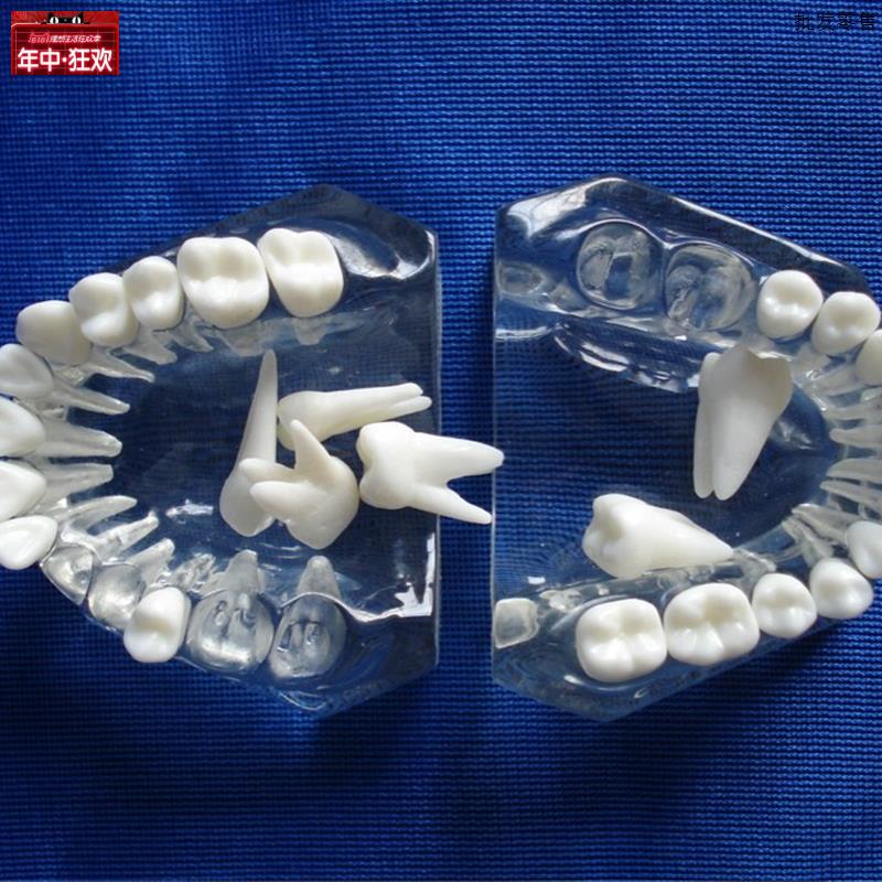 水晶透明牙模型o可拆卸拔牙练习牙齿解剖构造模型