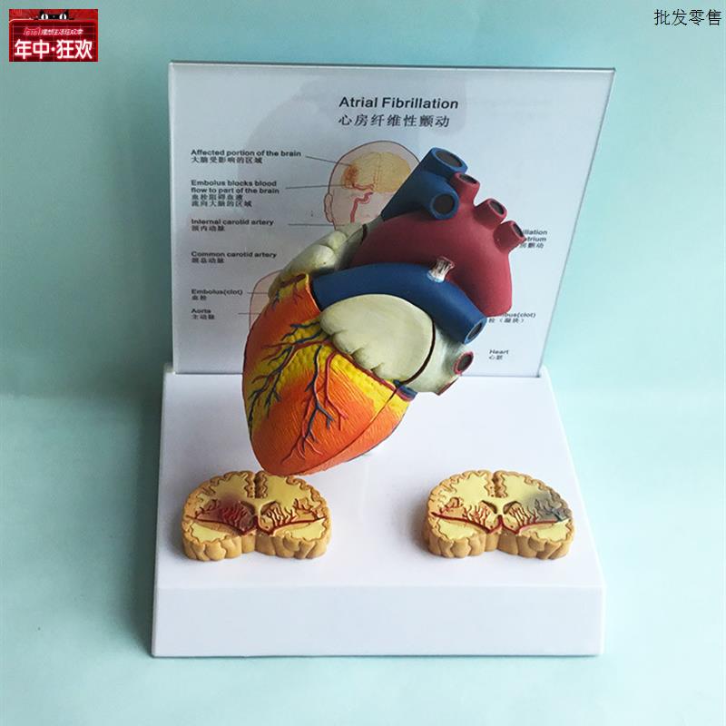 人体心房纤维性颤动心k房纤颤脑溢血心脏模型心脏解剖模型医学教