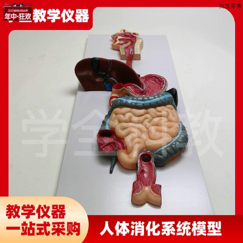 人体消化系统模型结v肠病理病变肛肠科大肠肠道医学疾病解剖内脏