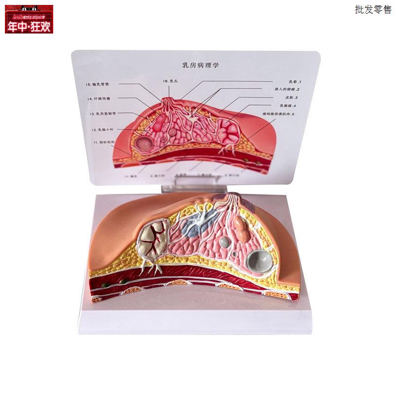乳房模型乳腺增J生家政培训妇产乳腺演示哺乳期乳房构造催乳师教