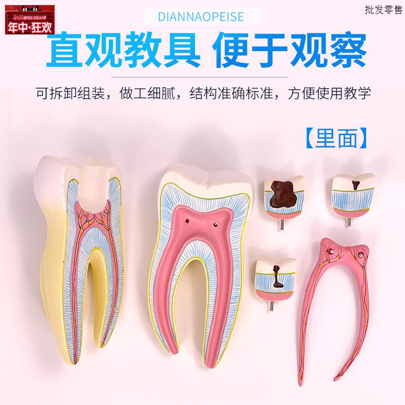 臼牙磨牙牙齿模型人体解剖放大牙齿模d具儿童牙齿玩具教具模型