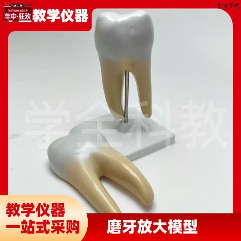 磨牙放大模F型蛀牙牙齿结构口腔牙医学牙科医患沟通尖牙切牙