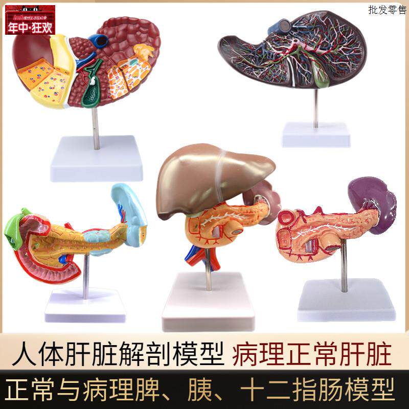 人体肝脏模型肝解剖模型肝胆胰脾十二指肠病变A肝胆胰胆囊消化内