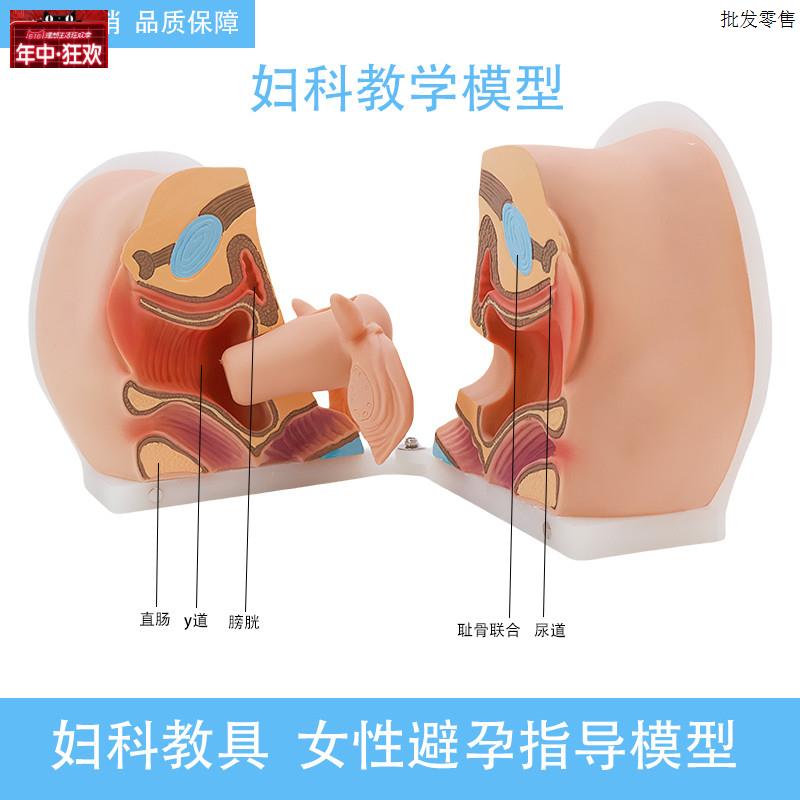 女性避孕器安装指导模型m子宫卵巢生殖器官解剖模型医院用学校教