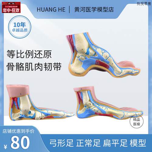 正常足弓形足高弓足n模型脚关节模型爪形足脚部模型解剖医院