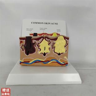 人体皮肤解剖模型医p学教学毛囊病理炎病态人体皮肤带说明版