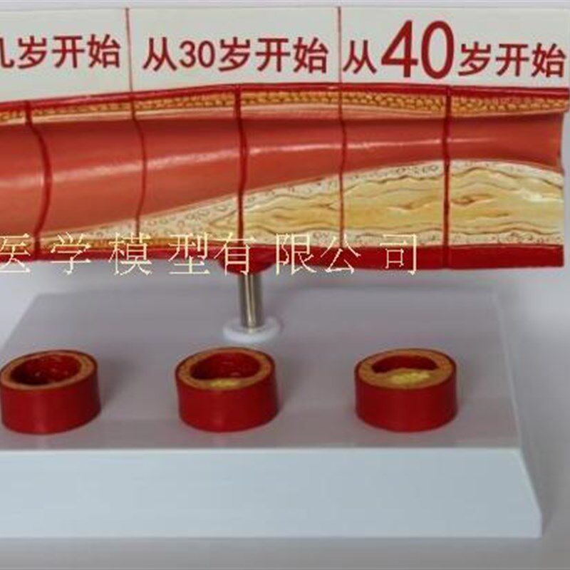 人体血管解剖g模型 血管模型 硬化动脉展示 各阶段年龄层血管演示