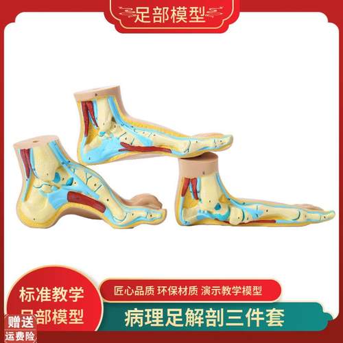 脚模型正常足扁平足弓型足解剖模型脚部H构结构造肌肉血管教学医
