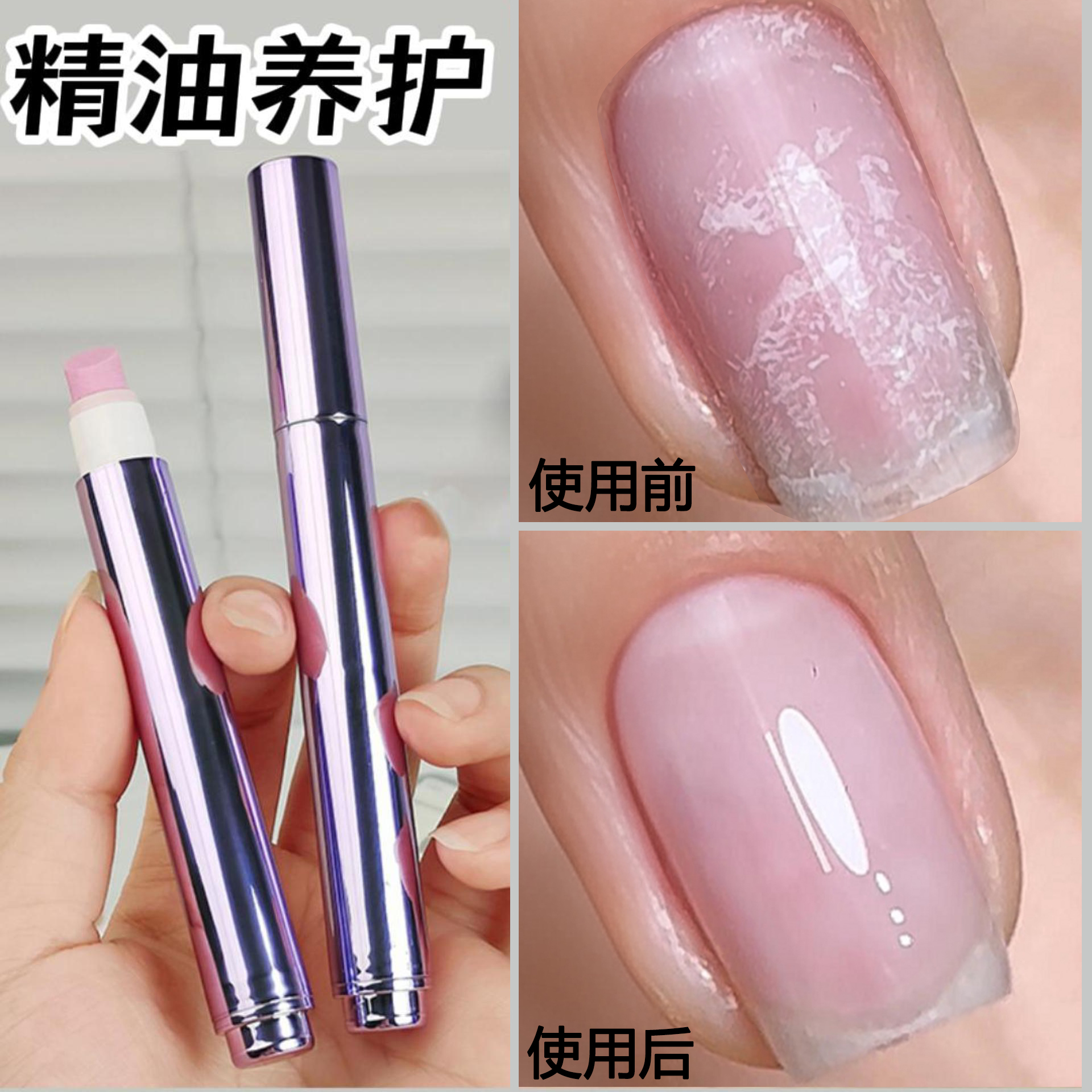 护甲营养液防断裂去死皮修复指甲