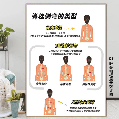 儿童脊柱侧弯海报整脊正骨图片