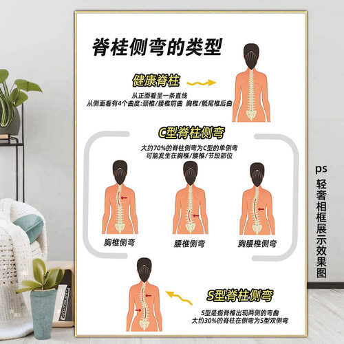 儿童脊柱侧弯海报整脊正骨图片