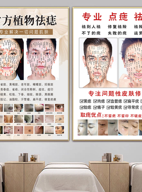 祛痣祛疣宣传画点痣广告图kt板男女面痣图取痣挂画痣相图祛斑海报