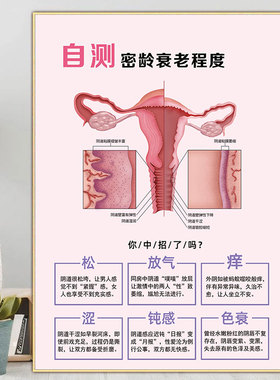 私密海报子宫挂画妇科保养装饰画衰老自测广告图女性私密宣传图片