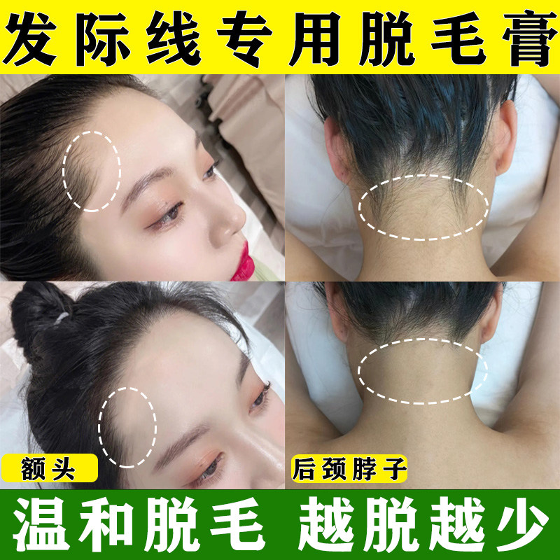 发际线专用脱毛膏脱额头后脖子美人尖耳边碎发鬓角汗毛发际线全身