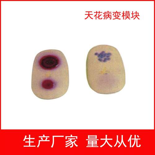 天花病变模块护理模型天花病毒检C查模型医学教学模型护士实习用