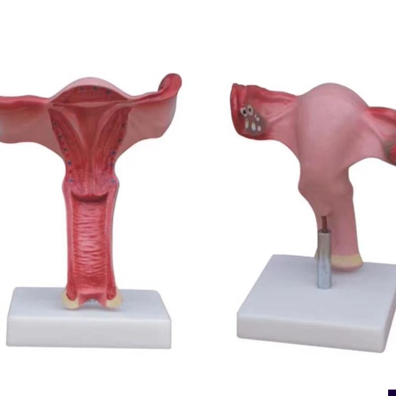 子宫放大模型阴道生殖器官y卵巢输卵管剖面教学训练解剖模具