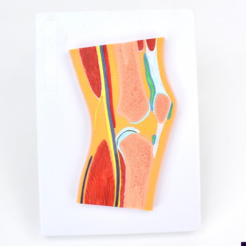 ENOVOd颐诺医学膝关节骨骼肌肉模型滑车关节构造MRI骨科教学模型