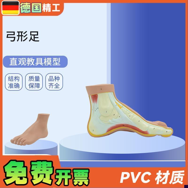 德国】PNT-0727弓形w足模型足部病理模型人体足部解剖模型脚关