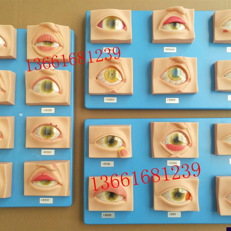 人体常见眼病模型常用眼科疾病模具教G学指导病态眼睛示教标本20