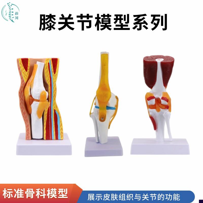 人体膝关节功能模型骨骼模型教学医用模型人O体肌肉关节病理模型