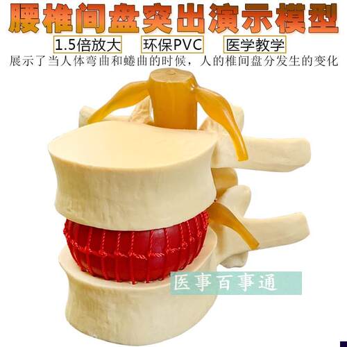 脊柱模型脊c椎骨头腰椎间盘模具椎体模型突出受压病理骨质教具包